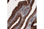 Immunohistochemical staining of human fallopian tube shows strong cytoplasmic immunoreactivity in epithelial cells.