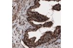 Immunohistochemical staining of human prostate shows strong cytoplasmic immunoreactivity in epithelial cells.