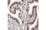 Immunohistochemical staining of human Fallopian tube shows strong nuclear positivity in glandular cells.
