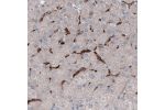 Immunohistochemical staining of human liver shows strong immunoreactivity in Kupffer cells.