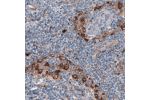 Immunohistochemical staining of human lymph node shows strong positivity in a subset of lymphoid cells.