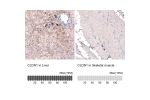 Immunohistochemistry analysis in human liver and skeletal muscle tissues using AMAb91213 antibody. Corresponding CLDN1 RNA-seq data are presented for the same tissues.