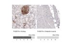 Immunohistochemistry analysis in human kidney and skeletal muscle tissues using AMAb91233 antibody. Corresponding THSD7A RNA-seq data are presented for the same tissues.
