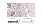 Immunohistochemistry analysis in human kidney and skeletal muscle tissues using AMAb91234 antibody. Corresponding THSD7A RNA-seq data are presented for the same tissues.