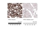 Immunohistochemistry analysis in human placenta and skeletal muscle tissues using AMAb91245 antibody. Corresponding PPIB RNA-seq data are presented for the same tissues.