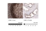 Immunohistochemical staining of human tonsil shows strong nuclear membrane immunoreactivity in lymphoid cells.