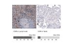 Immunohistochemistry analysis in human lymph node and testis tissues using AMAb91252 antibody. Corresponding VSIR RNA-seq data are presented for the same tissues.
