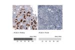 Immunohistochemistry analysis in human kidney and tonsil tissues using AMAb91259 antibody. Corresponding ACE2 RNA-seq data are presented for the same tissues.