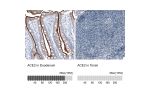 Immunohistochemistry analysis in human duodenum and tonsil tissues using AMAb91262 antibody. Corresponding ACE2 RNA-seq data are presented for the same tissues.