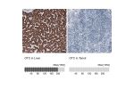 Immunohistochemistry analysis in human liver and tonsil tissues using AMAb91264 antibody. Corresponding OTC RNA-seq data are presented for the same tissues.