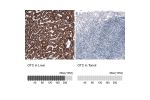 Immunohistochemical staining of human duodenum shows strong granular cytoplasmic immunoreactivity in glandular cells.