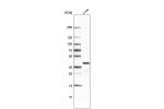 Western blot analysis in human liver tissue.