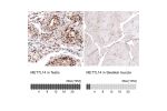 Immunohistochemistry analysis in human testis and skeletal muscle tissues using AMAb91275 antibody. Corresponding METTL14 RNA-seq data are presented for the same tissues.