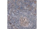 Immunohistochemical staining of human lymph node shows moderate cytoplasmic and nuclear positivity in germinal center cells.