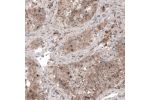 Immunohistochemical staining of human testis shows moderate cytoplasmic positivity in cells in seminiferous ducts.