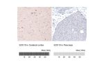 Immunohistochemical staining of human cerebral cortex shows strong nuclear immunoreactivity in a subset of glial cells.