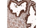 Immunohistochemical staining of human prostate shows strong granular cytoplasmic immunoreactivity in glandular cells and moderate positivity in smooth muscle.