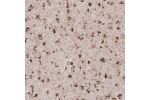 Immunohistochemical staining of human cerebral cortex shows strong granular cytoplasmic positivity in neuronal cells.