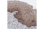 Immunohistochemical staining of human cervix shows granular cytoplasmic immunoreactivity in squamous epithelium cells.
