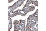Immunohistochemical staining of human fallopian tube shows granular cytoplasmic immunoreactivity in glandular and connective tissue cells.