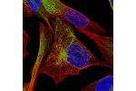 Immunofluorescence staining of RH-30 cells using the Anti-DES monoclonal antibody, showing specific staining of intermediate filaments in green. Microtubule- and nuclear probes are visualized in red and blue, respectively (where available).