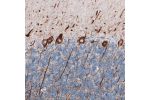 Immunohistochemical staining of human cerebellum shows strong cytoplasmic immunoreactivity in cell bodies and proximal dendrites of Purkinje cells.