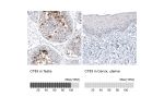 Immunohistochemistry analysis in human testis and cervix, uterine tissues using AMAb91318 antibody. Corresponding CT83 RNA-seq data are presented for the same tissues.