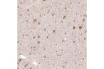 Immunohistochemical staining of human cerebral cortex shows moderate cytoplasmic positivity in neurons.