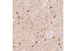 Immunohistochemical staining of cerebral cortex shows strong cytoplasmic immunoreactivity in neurons.