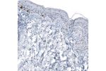 Immunohistochemical staining of human skin shows strong cytoplasmic immunoreactivity in melanocytes.