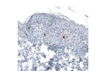 Immunohistochemical staining of human skin shows strong cytoplasmic immunoreactivity in melanocytes.