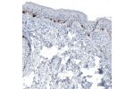 Immunohistochemical staining of human skin shows strong cytoplasmic immunoreactivity in melanocytes.