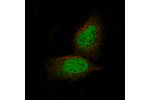 Immunofluorescence staining of U-2 OS cells using the Anti-PRAME monoclonal antibody, showing specific staining in the nucleus and cytosol in green. Microtubule- and nuclear probes are visualized in red and blue, respectively (where available).
