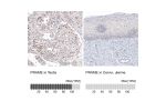Immunohistochemistry analysis in human testis and cervix, uterine tissues using AMAb91330 antibody. Corresponding PRAME RNA-seq data are presented for the same tissues.