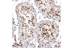 Immunohistochemical staining of human testis shows moderate to strong nuclear positivity in cells in seminiferous ducts.