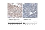 Immunohistochemistry analysis in human heart muscle and tonsil tissues using AMAb91356 antibody. Corresponding LAPTM4B RNA-seq data are presented for the same tissues.