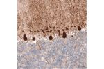 Immunohistochemical staining of human cerebellum shows strong cytoplasmic positivity in Purkinje cells.
