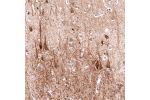 Immunohistochemical staining of human cerebral cortex shows cytoplasmic immunoreactivity in neurons, as well as positivity in neuropil.