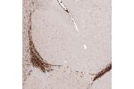 Immunohistochemical staining of mouse brain shows strong nuclear positivity in rostral migratory stream cells.