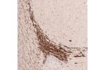 Immunohistochemical staining of mouse forebrain shows strong positivity in cells in rostral migratory stream.
