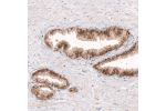 Immunohistochemical staining of human prostate shows moderate granular cytoplasmic immunoreactivity in glandular cells.