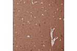 Immunohistochemical staining of human cerebral cortex shows strong positivity in neuropil as well as in neurons.