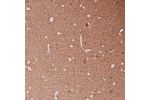 Immunohistochemical staining of human cerebral cortex shows strong positivity in neuropil as well as in neurons.