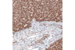 Immunohistochemical staining of human liver shows moderate cytoplasmic positivity in hepatocytes.