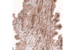 Immunohistochemical staining of human prostate shows moderate membranous positivity in glandular cells as well as in smooth muscle cells.