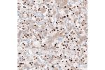 Immunohistochemical staining of human pituitary gland shows strong nuclear immunoreactivity in a subset of cells in the adenohypophysis.