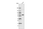 Western blot analysis in human cell line HL-60.