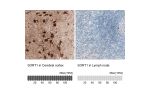Immunohistochemistry analysis in human cerebral cortex and lymph node tissues using AMAb91427 antibody. Corresponding SORT1 RNA-seq data are presented for the same tissues.