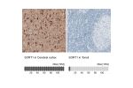 Immunohistochemistry analysis in human cerebral cortex and tonsil tissues using AMAb91428 antibody. Corresponding SORT1 RNA-seq data are presented for the same tissues.