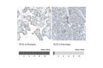 Immunohistochemistry analysis in human placenta and pancreas tissues using AMAb91439 antibody. Corresponding TET2 RNA-seq data are presented for the same tissues.